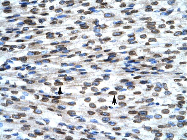 BAX antibody LS-C30593 was used in IHC to stain formalin-fixed, paraffin-embedded human heart.