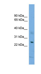 BAX antibody LS-C117074 Western blot of HepG2 cell lysate.
