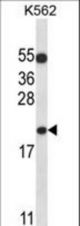 BAX Antibody western blot of K562 cell line lysates (35 ug/lane). The BAX antibody detected the BAX protein (arrow).