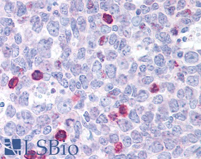Anti-BAX antibody IHC of human tonsil. Immunohistochemistry of formalin-fixed, paraffin-embedded tissue after heat-induced antigen retrieval. Antibody LS-B1333 concentration 2 ug/ml.