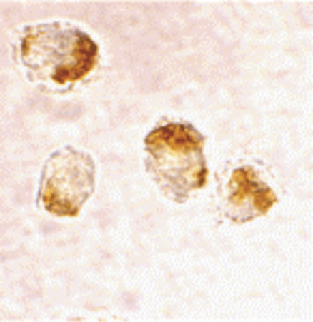 Immunocytochemistry staining of HL-60 cells using Bax at 2 ug/ml.