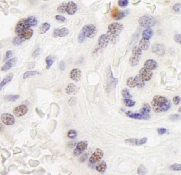 Detection of Human WSTF by Immunohistochemistry. Sample: FFPE section of human placenta. Antibody: Affinity purified rabbit anti-WSTF used at a dilution of 1:200 (1 ug/ml). Detection: DAB.