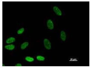 Immunofluorescent staining using BAZ1B antibody. Immunostaining analysis in HeLa cells. HeLa cells were fixed with 4% paraformaldehyde and permeabilized with 0.01% Triton-X100 in PBS. The cells were immunostained with anti-BAZ1B antibody.