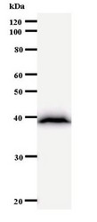 Western blot of immunized recombinant protein using BAZ1B antibody.
