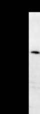 Detection of human BAZ1B by Western blot. Samples: Whole cell lysate (25 ug) from HeLa cells. Predicted molecular weight: 176 kDa