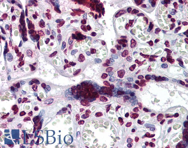 Anti-BAZ1B / WSTF antibody IHC of human placenta. Immunohistochemistry of formalin-fixed, paraffin-embedded tissue after heat-induced antigen retrieval. Antibody LS-B6194 concentration 3 ug/ml.