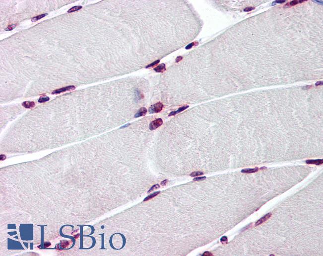 Anti-BAZ1B / WSTF antibody IHC of human skeletal muscle. Immunohistochemistry of formalin-fixed, paraffin-embedded tissue after heat-induced antigen retrieval. Antibody LS-B6194 concentration 3 ug/ml.