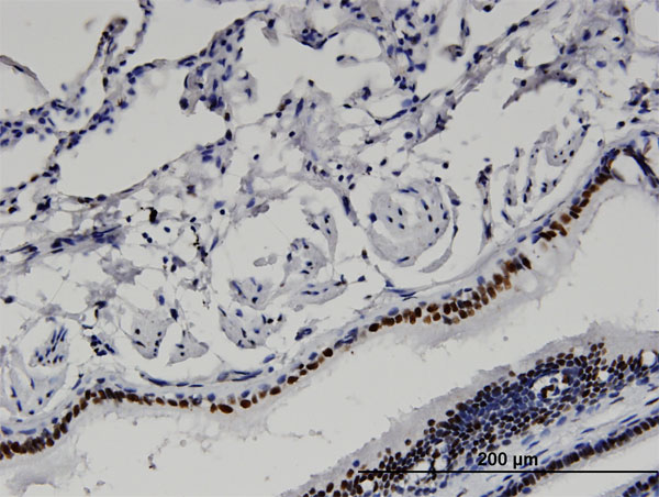 Immunoperoxidase of monoclonal antibody to BAZ2B on formalin-fixed paraffin-embedded human lung. [antibody concentration 3 ug/ml]