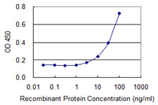 Detection limit for recombinant GST tagged BAZ2B is 0.3 ng/ml as a capture antibody.