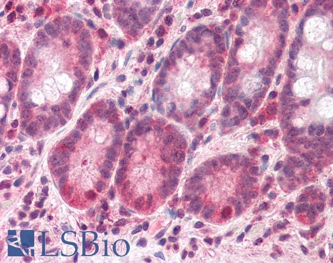 Anti-BAZ2B antibody IHC of human small intestine. Immunohistochemistry of formalin-fixed, paraffin-embedded tissue after heat-induced antigen retrieval. Antibody LS-B2276 concentration 5 ug/ml.