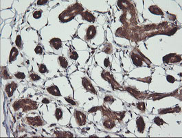 IHC of paraffin-embedded Human breast tissue using anti-BBOX1 mouse monoclonal antibody. (Heat-induced epitope retrieval by 10mM citric buffer, pH6.0, 120°C for 3min).