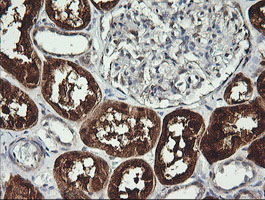 IHC of paraffin-embedded Human Kidney tissue using anti-BBOX1 mouse monoclonal antibody. (Heat-induced epitope retrieval by 10mM citric buffer, pH6.0, 120°C for 3min).