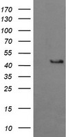 HEK293T cells were transfected with the pCMV6-ENTRY control (Left lane) or pCMV6-ENTRY BBOX1 (Right lane) cDNA for 48 hrs and lysed. Equivalent amounts of cell lysates (5 ug per lane) were separated by SDS-PAGE and immunoblotted with anti-BBOX1.