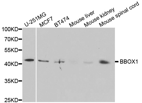Western blot analysis of extracts of various cell lines, using BBOX1 antibody.