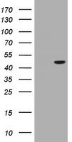 HEK293T cells were transfected with the pCMV6-ENTRY control (Left lane) or pCMV6-ENTRY BBOX1 (Right lane) cDNA for 48 hrs and lysed. Equivalent amounts of cell lysates (5 ug per lane) were separated by SDS-PAGE and immunoblotted with anti-BBOX1.