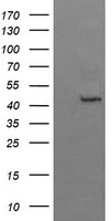 HEK293T cells were transfected with the pCMV6-ENTRY control (Left lane) or pCMV6-ENTRY BBOX1 (Right lane) cDNA for 48 hrs and lysed. Equivalent amounts of cell lysates (5 ug per lane) were separated by SDS-PAGE and immunoblotted with anti-BBOX1.