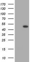 HEK293T cells were transfected with the pCMV6-ENTRY control (Left lane) or pCMV6-ENTRY BBOX1 (Right lane) cDNA for 48 hrs and lysed. Equivalent amounts of cell lysates (5 ug per lane) were separated by SDS-PAGE and immunoblotted with anti-BBOX1.