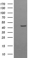 HEK293T cells were transfected with the pCMV6-ENTRY control (Left lane) or pCMV6-ENTRY BBOX1 (Right lane) cDNA for 48 hrs and lysed. Equivalent amounts of cell lysates (5 ug per lane) were separated by SDS-PAGE and immunoblotted with anti-BBOX1.