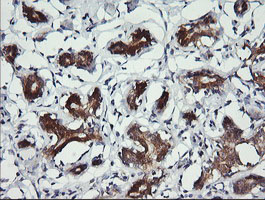 IHC of paraffin-embedded Human breast tissue using anti-BBOX1 mouse monoclonal antibody.