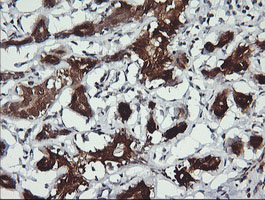 IHC of paraffin-embedded Human breast tissue using anti-BBOX1 mouse monoclonal antibody.