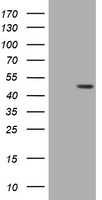 HEK293T cells were transfected with the pCMV6-ENTRY control (Left lane) or pCMV6-ENTRY BBOX1 (Right lane) cDNA for 48 hrs and lysed. Equivalent amounts of cell lysates (5 ug per lane) were separated by SDS-PAGE and immunoblotted with anti-BBOX1.