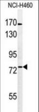 Western blot of BBS10 Antibody in NCI-H460 cell line lysates (35 ug/lane). BBS10 (arrow) was detected using the purified antibody.