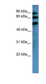 BBS2 antibody LS-C135606 Western blot of COLO205 cell lysate.