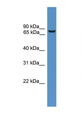 BBS2 antibody LS-C135607 Western blot of MCF7 Cell lysate. Antibody concentration 1 ug/ml.
