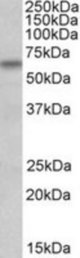 BBS4 antibody (1 ug/ml) staining of HeLa lysate (35 ug protein/ml in RIPA buffer). Primary incubation was 1 hour. Detected by chemiluminescence.