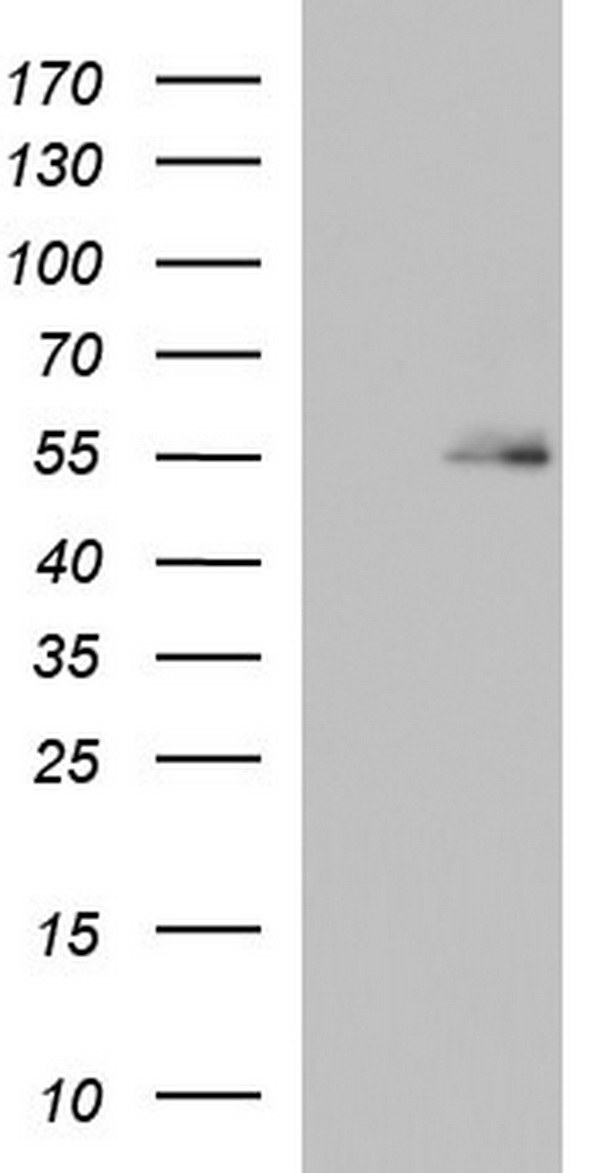 HEK293T cells were transfected with the pCMV6-ENTRY control (Left lane) or pCMV6-ENTRY BBS4 (Right lane) cDNA for 48 hrs and lysed. Equivalent amounts of cell lysates (5 ug per lane) were separated by SDS-PAGE and immunoblotted with anti-BBS4.