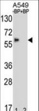 Western blot of BBS4 Antibody antibody pre-incubated without(lane 1) and with(lane 2) blocking peptide in A549 cell line lysate. BBS4 Antibody (arrow) was detected using the purified antibody.