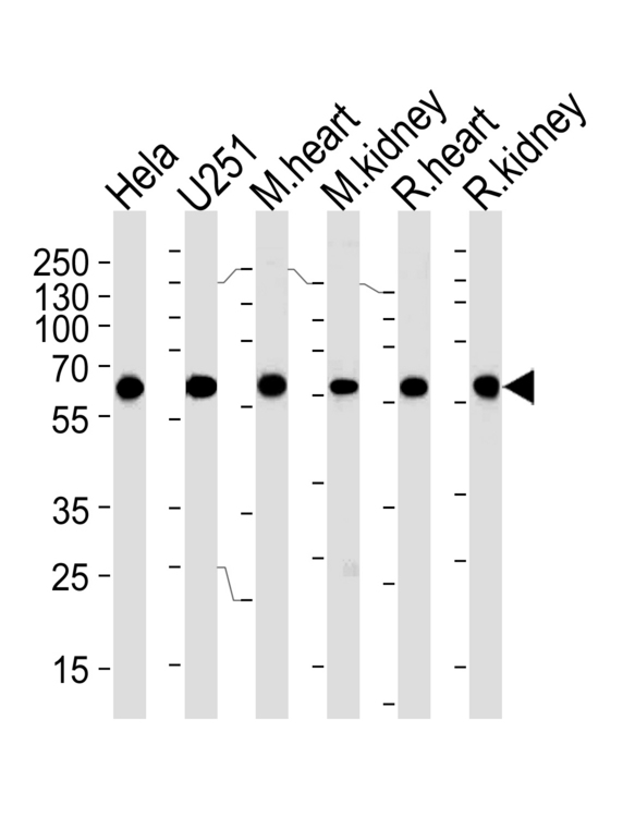 Western blot of lysates from HeLa, U251 cell line, mouse heart and kidney, rat heart and kidney tissue (from left to right) with PHB Antibody. Antibody was diluted at 1:1000 at each lane. A goat anti-mouse IgG H&L (HRP) at 1:3000 dilution was used as the secondary antibody. Lysates at 35 ug per lane.