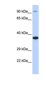 BBS5 antibody LS-C102493 Western blot of 293T cell lysate.