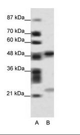 A: Marker, B: HepG2 Cell Lysate