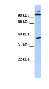 PHF11 antibody LS-C101740 Western blot of MCF7 cell lysate.