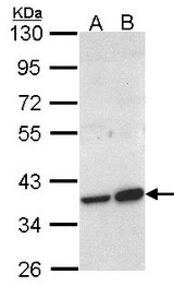 Sample (30 ug of whole cell lysate). A: Molt-4 , B: Raji. 10% SDS PAGE. ACMSD antibody diluted at 1:1000.