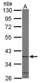 Sample (50 ug of whole cell lysate). A: Mouse brain. 10% SDS PAGE. ACMSD antibody diluted at 1:1000.