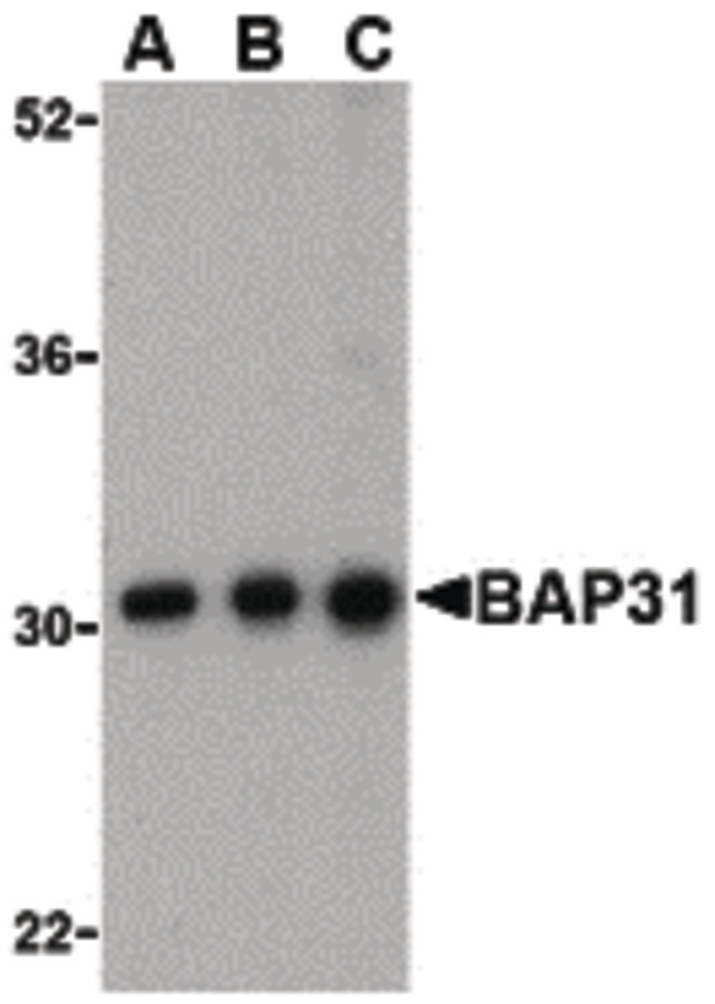 Western blot of BAP31 in Ramos cell lysate with BAP31 antibody at (A) 0.5, (B) 1 and (C) 2ug/ml.