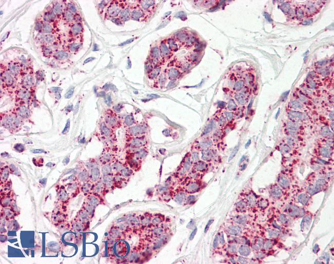 Anti-ACO2 / Aconitase 2 antibody IHC of human breast. Immunohistochemistry of formalin-fixed, paraffin-embedded tissue after heat-induced antigen retrieval. Antibody LS-B8320 dilution 3.75 ug/ml.