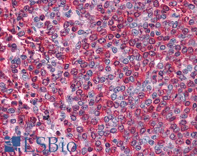 Anti-BCAS2 antibody IHC of human spleen. Immunohistochemistry of formalin-fixed, paraffin-embedded tissue after heat-induced antigen retrieval. Antibody LS-B4632 concentration 5 ug/ml.