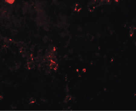 Immunofluorescence of BCAS2 in human breast carcinoma tissue with BCAS2 antibody at 20 ug/ml.