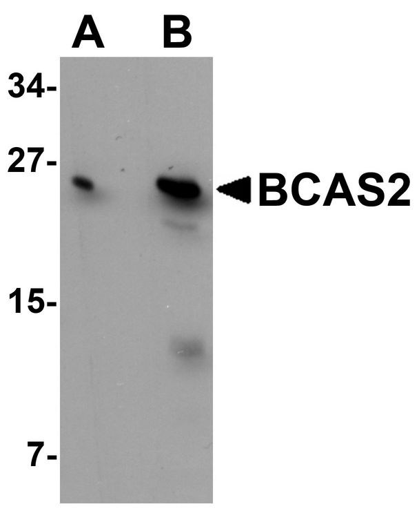 Western blot analysis of BCAS2 in MCF7 cell lysate with BCAS2 antibody at (A) 0.5 and (B) 1 ug/ml.