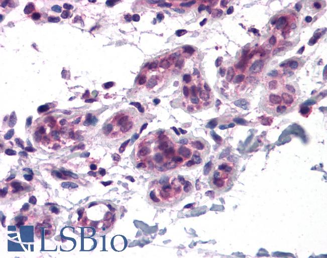 Anti-BCAS3 antibody IHC of human breast. Immunohistochemistry of formalin-fixed, paraffin-embedded tissue after heat-induced antigen retrieval. Antibody LS-B4633 concentration 5 ug/ml.