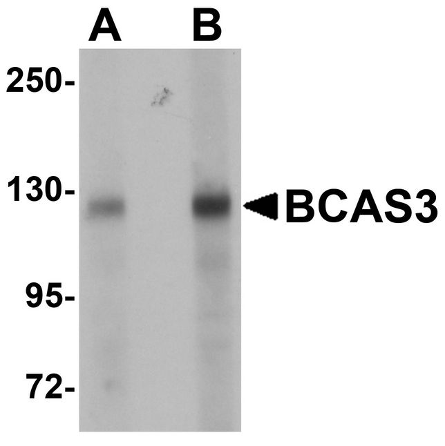 Western blot analysis of BCAS3 in rat brain tissue lysate with BCAS3 antibody at (A) 0.5 and (B) 1 ug/ml.