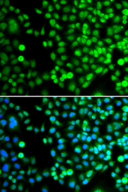 Immunofluorescence blot of MCF7 cell using BCAS3 antibody. Blue: DAPI for nuclear staining.