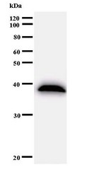 Western blot of immunized recombinant protein using BCAS3 antibody.