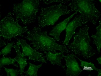 Immunostaining analysis in HeLa cells. HeLa cells were fixed with 4% paraformaldehyde and permeabilized with 0.1% Triton X-100 in PBS. The cells were immunostained with anti-BCAS3 mAb.