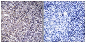 IHC of paraffin-embedded human tonsil tissue, using BCAS4 Antibody. The picture on the right is treated with the synthesized peptide.