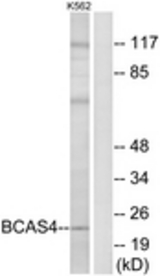 Western blot of extracts from K562 cells, using BCAS4 Antibody. The lane on the right is treated with the synthesized peptide.