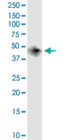 BCAT1 monoclonal antibody (M02), clone 1F8. Western Blot analysis of BCAT1 expression in human kidney.